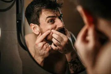 How-to-Treat-and-Prevent-Beard-Acne-Expert-Tips-and-Product-Recommendations Northridge Oak